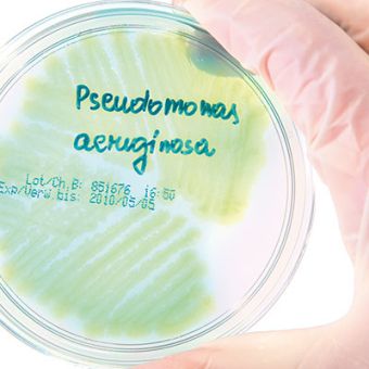 Le Pseudomonas aeruginosa